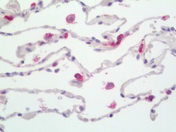 14 - Anti-HLA-DPB1 Antibody  ALS17272