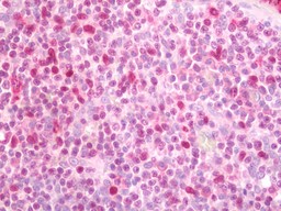 14 - Anti-SPI1 / PU.1 Antibody  ALS17274