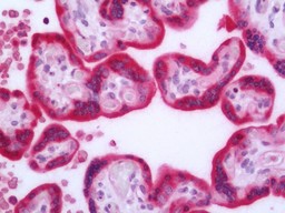 14 - Anti-HDAC7 Antibody  ALS17277