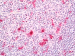 14 - Anti-IL18 Antibody  ALS17279