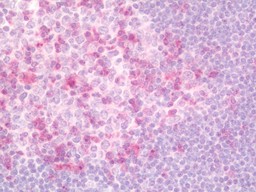 14 - Anti-SKAP1 / SCAP1 Antibody  ALS17280