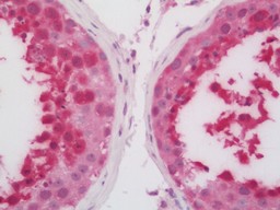 14 - Anti-HSPA6 / HSP70B' Antibody  ALS17281