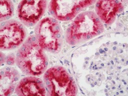 14 - Anti-CST3 / Cystatin C Antibody  ALS17282