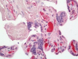 14 - Anti-Complement C3 Antibody  ALS17285