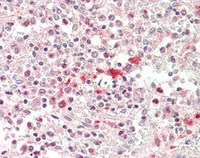 14 - Anti-ABCB7 Antibody (C-Terminus)  ALS17287