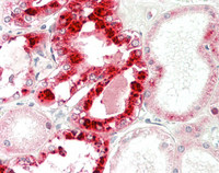 14 - Anti-REN / Renin 1 Antibody (aa131-406, clone 2B9)  ALS17288