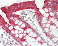 14 - Anti-CO-029 / TSPAN8 Antibody (Internal)  ALS17291