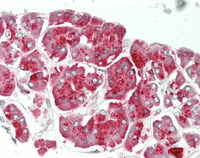 14 - Anti-CPA1 / Carboxypeptidase A Antibody (aa301-350)  ALS17295