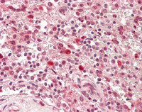 14 - Anti-ARRB1 / Beta Arrestin 1 Antibody  ALS17296