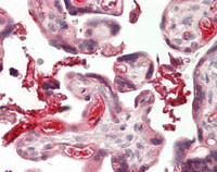 14 - Anti-CXCL7 / PPBP Antibody  ALS17299