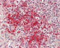14 - Anti-CXCL7 / PPBP Antibody  ALS17299