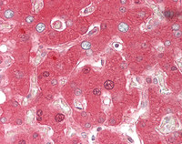 14 - Anti-Antithrombin-III Antibody  ALS17300