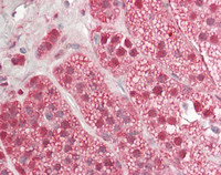 14 - Anti-RFX / RFX1 Antibody (C-Terminus)  ALS17302