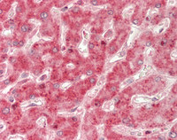 14 - Anti-VTI1A Antibody (Internal)  ALS17305