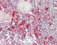 14 - Anti-SUSD3 Antibody  ALS17310