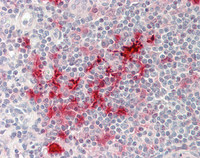 14 - Anti-SUSD3 Antibody  ALS17310