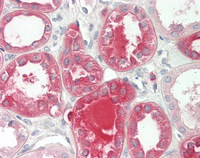 14 - Anti-ADCY9 / Adenylate Cyclase 9 Antibody (aa984-1029)  ALS17314