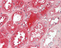 14 - Anti-SERPING1 / C1 Inhibitor Antibody (clone KT28)  ALS17315