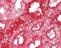 14 - Anti-APOA1 / Apolipoprotein A 1 Antibody  ALS17317