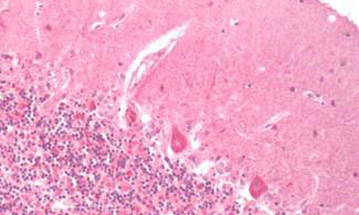 14 - Anti-PTHR2 / PTH2R Antibody (N-Terminus)  ALS17320