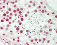 14 - Anti-TROP2 / TACSTD2 Antibody (Internal)  ALS17323
