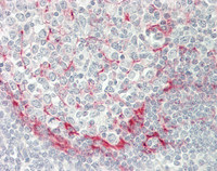 14 - Anti-DMN / Desmuslin / Synemin Antibody (aa329-580, clone 2F4)  ALS17324
