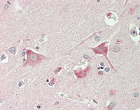14 - Anti-KCNJ16 / Kir5.1 Antibody (aa376-428)  ALS17326