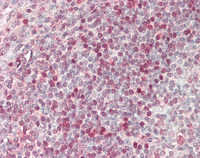 14 - Anti-MCPH1 Antibody (aa1-264, clone 1B2)  ALS17329