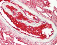 14 - Anti-HPX / Hemopexin Antibody  ALS17333