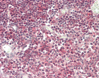 14 - Anti-ESPL1 / Separase Antibody (N-Terminus)  ALS17335