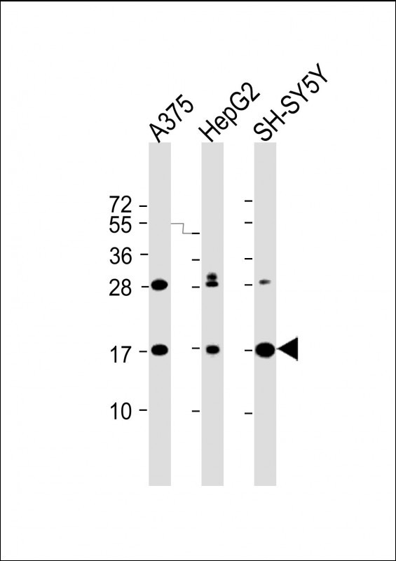 1 - SRP14 Antibody (Center) AP19074c