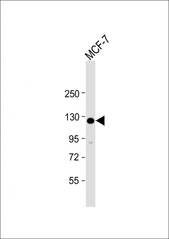 1 - HEATR6 Antibody (N-Term) AP22198a