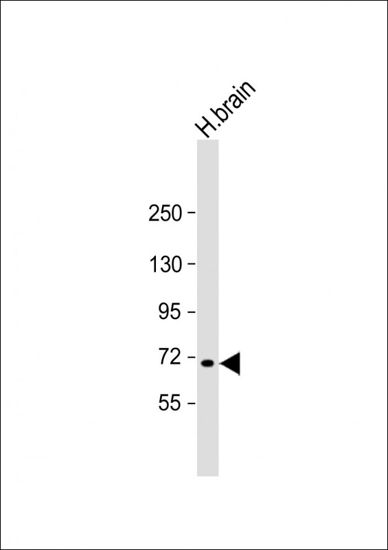 1 - MAN1C1 Antibody (N-Term) AP22200a