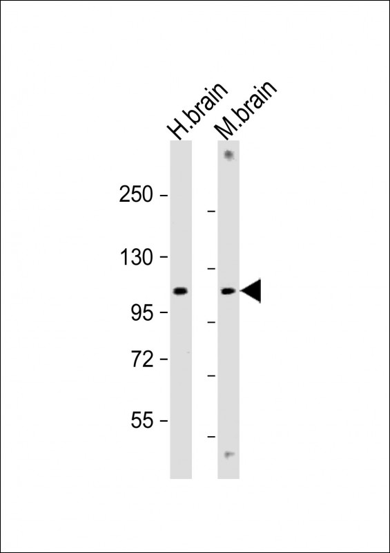1 - GBA2 Antibody (Center) AP22212c