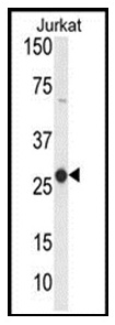 1 - CD160 Polyclonal Antibody ABV11718