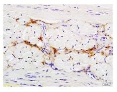 2 - CD47/MER6 Polyclonal Antibody ABV11723