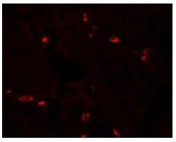 3 - BTLA Polyclonal Antibody ABV11728
