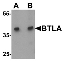 1 - BTLA Polyclonal Antibody ABV11728