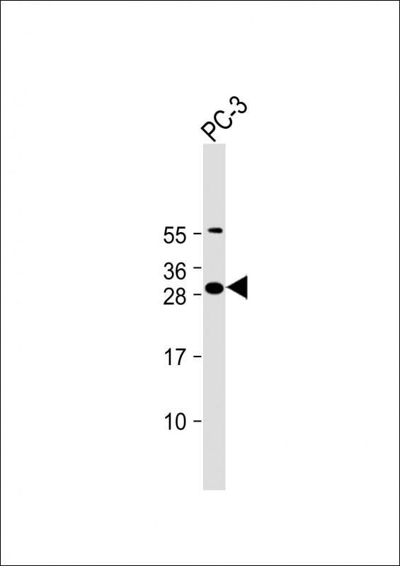 1 - FAM125A Antibody (N-Term) AP22249a