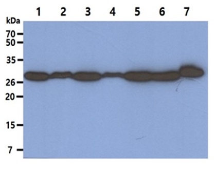 1 - PSME1 Monoclonal Antibody ABV11771