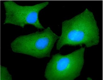 3 - FSCN1 Monoclonal Antibody ABV11772
