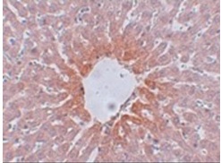 2 - AGTR2 Polyclonal Antibody ABV11773
