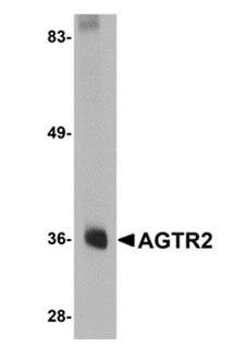 1 - AGTR2 Polyclonal Antibody ABV11773