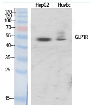 1 - GLP-1R Polyclonal Antibody ABV11775