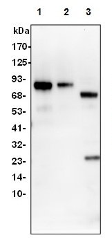 1 - Prothrombin Antibody ABV11808
