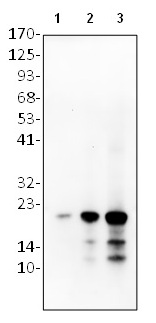 1 - HRV14 3C Antibody ABV11809