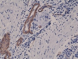 2 - Anti-CD146 Rabbit Monoclonal Antibody  ABV11816