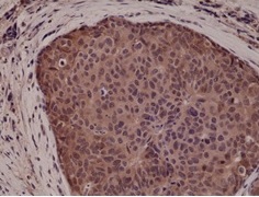 2 - Anti-p38 MAPK Rabbit Monoclonal Antibody ABV11819