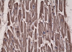 2 - Anti- Acetyl-CoA Carboxylase 1, Rabbit Monoclonal Antibody ABV11827