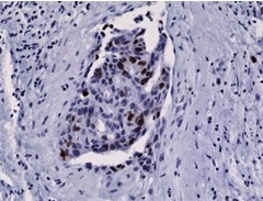 2 - Anti-KI67 Rabbit Monoclonal Antibody ABV11829